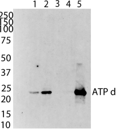 Western blot - Anti-ATP5H antibody [7F9BG1] (AB110275), expandable thumbnail