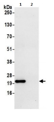 Immunoprecipitation - Anti-ATP5H antibody (AB241164)