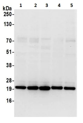Western blot - Anti-ATP5H antibody (AB241164)