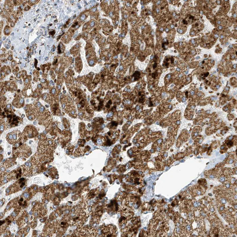 Immunohistochemistry (Formalin/PFA-fixed paraffin-embedded sections) - Anti-ATP5I antibody (AB122241)