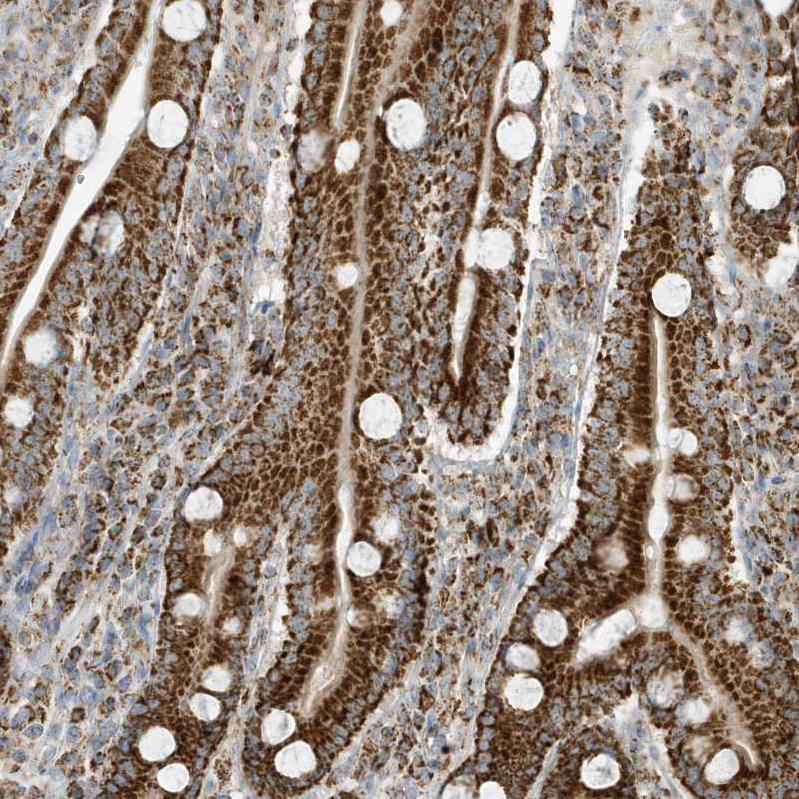 Immunohistochemistry (Formalin/PFA-fixed paraffin-embedded sections) - Anti-ATP5I antibody (AB122241)