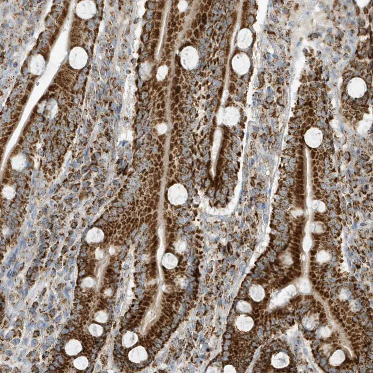 Immunohistochemistry (Formalin/PFA-fixed paraffin-embedded sections) - Anti-ATP5I antibody (AB122241)
