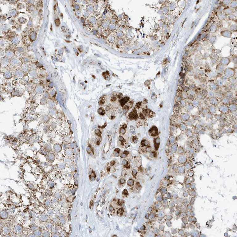 Immunohistochemistry (Formalin/PFA-fixed paraffin-embedded sections) - Anti-ATP5I antibody (AB122241)