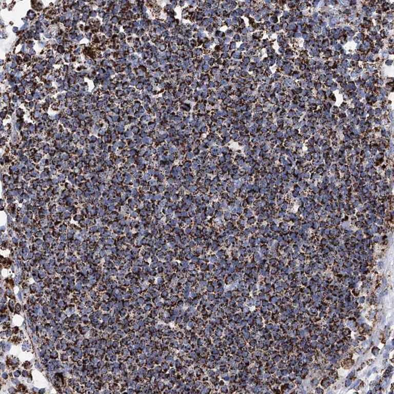 Immunohistochemistry (Formalin/PFA-fixed paraffin-embedded sections) - Anti-ATP5J antibody (AB224139)