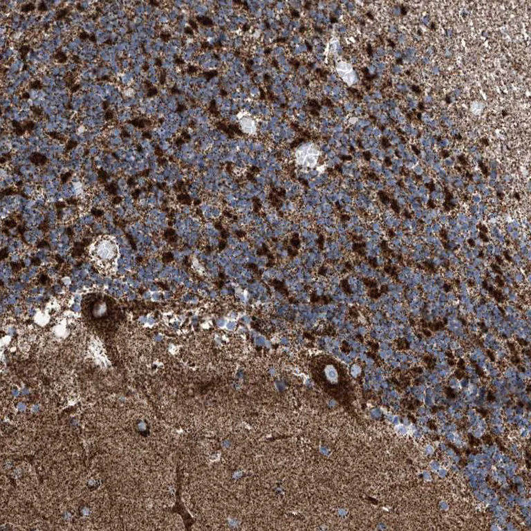 Immunohistochemistry (Formalin/PFA-fixed paraffin-embedded sections) - Anti-ATP5J antibody (AB224139)