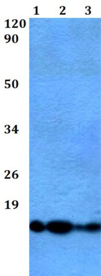 Western blot - Anti-ATP5J2 antibody (AB200715)