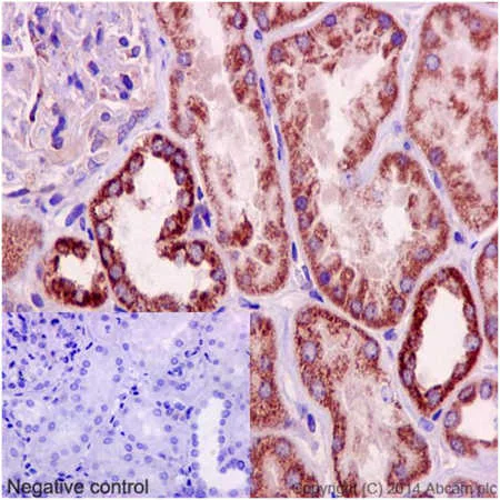 Immunohistochemistry (Formalin/PFA-fixed paraffin-embedded sections) - Anti-ATP5L2 + ATP5L antibody [EPR15636] (AB191417)