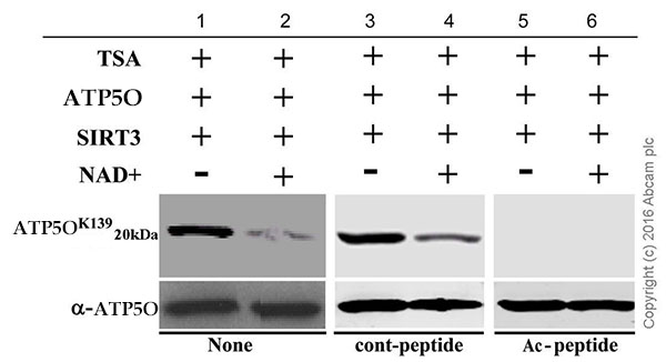Western blot - Anti-ATP5O (acetyl K139) antibody [NCI-R155-13] (AB214339)