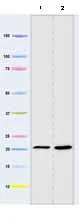 Western blot - Anti-ATP5O antibody [4C11C10D12] (AB110276)