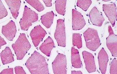 Immunohistochemistry (Formalin/PFA-fixed paraffin-embedded sections) - Anti-ATP5O antibody (AB230325)