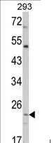 Western blot - Anti-ATP5O antibody (AB230325)