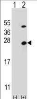 Western blot - Anti-ATP5O antibody (AB230325)