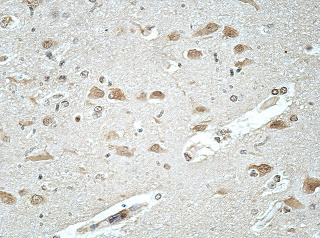 Immunohistochemistry (Formalin/PFA-fixed paraffin-embedded sections) - Anti-ATP6AP1/ATP6S1 antibody (AB176609)