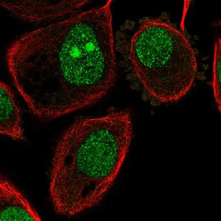 Immunocytochemistry/ Immunofluorescence - Anti-ATP6J/ATP6V1G1 antibody (AB220044)