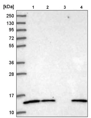 Western blot - Anti-ATP6J/ATP6V1G1 antibody (AB220044)