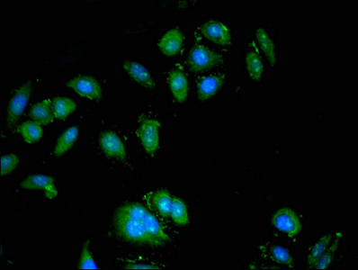 Immunocytochemistry/ Immunofluorescence - Anti-ATP6V0A1 antibody (AB237611)