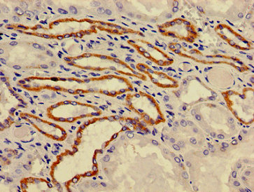 Immunohistochemistry (Formalin/PFA-fixed paraffin-embedded sections) - Anti-ATP6V0A1 antibody (AB237611)