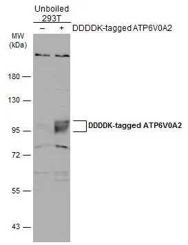 Western blot - Anti-ATP6V0A2 antibody (AB96803)