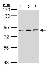 Western blot - Anti-ATP6V0A2 antibody (AB96803)