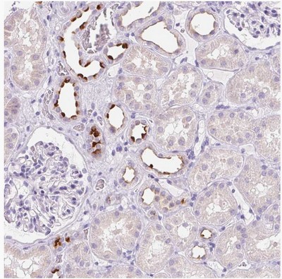 Immunohistochemistry (Formalin/PFA-fixed paraffin-embedded sections) - Anti-ATP6V0A4 antibody (AB204737)