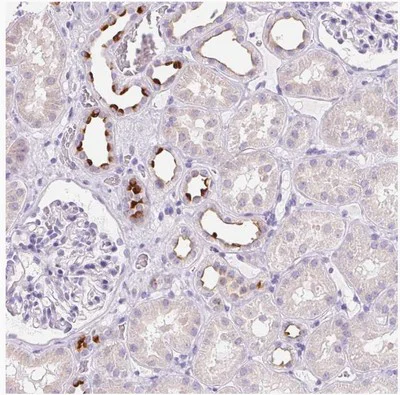 Immunohistochemistry (Formalin/PFA-fixed paraffin-embedded sections) - Anti-ATP6V0A4 antibody (AB204737)