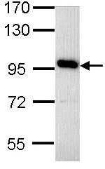 Western blot - Anti-ATP6V0A4 antibody (AB97440)