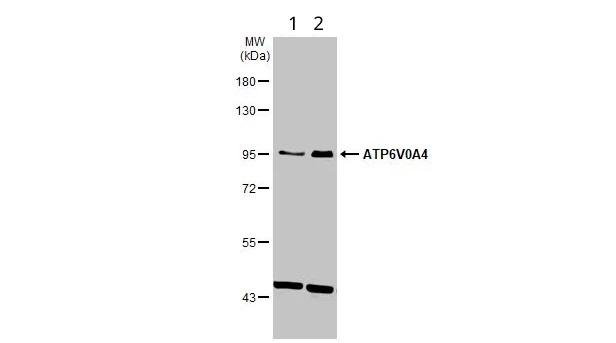 Western blot - Anti-ATP6V0A4 antibody (AB97440)