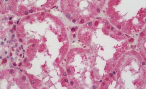 Immunohistochemistry (Formalin/PFA-fixed paraffin-embedded sections) - Anti-ATP6V0C antibody (AB230323)