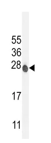 Western blot - Anti-ATP6V0C antibody (AB230323)