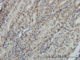 Immunohistochemistry (Formalin/PFA-fixed paraffin-embedded sections) - Anti-ATP6V0D1/P39 antibody [2G12] (AB56441)