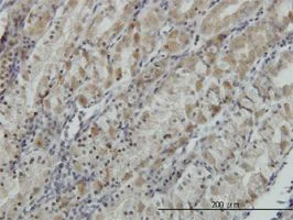 Immunohistochemistry (Formalin/PFA-fixed paraffin-embedded sections) - Anti-ATP6V0D1/P39 antibody [2G12] (AB56441)