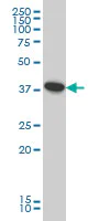 Western blot - Anti-ATP6V0D1/P39 antibody [2G12] (AB56441)