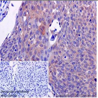 Immunohistochemistry (Formalin/PFA-fixed paraffin-embedded sections) - Anti-ATP6V0D1/P39 antibody [EPR18320-38] (AB202899)