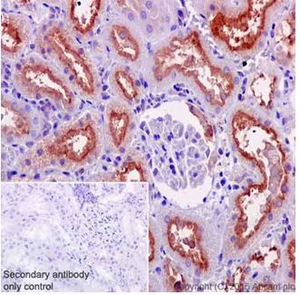 Immunohistochemistry (Formalin/PFA-fixed paraffin-embedded sections) - Anti-ATP6V0D1/P39 antibody [EPR18320-38] (AB202899)