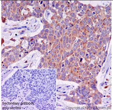 Immunohistochemistry (Formalin/PFA-fixed paraffin-embedded sections) - Anti-ATP6V0D1/P39 antibody [EPR18320-38] (AB202899)