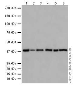Western blot - Anti-ATP6V0D1/P39 antibody [EPR18320-38] (AB202899)