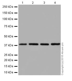 Western blot - Anti-ATP6V0D1/P39 antibody [EPR18320-38] (AB202899)
