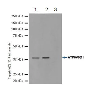 Immunoprecipitation - Anti-ATP6V0D1/P39 antibody [EPR18320-38] - BSA and Azide free (AB251387)