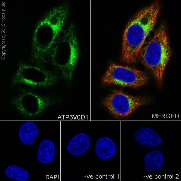Immunocytochemistry/ Immunofluorescence - Anti-ATP6V0D1/P39 antibody [EPR18320] (AB202897)