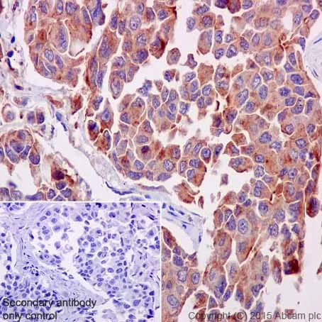 Immunohistochemistry (Formalin/PFA-fixed paraffin-embedded sections) - Anti-ATP6V0D1/P39 antibody [EPR18320] (AB202897)