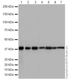 Western blot - Anti-ATP6V0D1/P39 antibody [EPR18320] (AB202897)