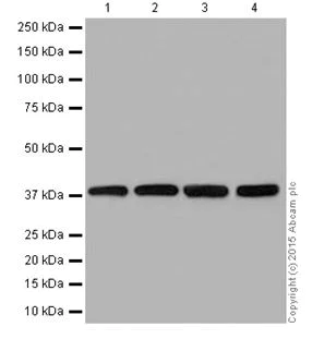 Western blot - Anti-ATP6V0D1/P39 antibody [EPR18320] (AB202897)