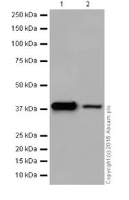 Western blot - Anti-ATP6V0D1/P39 antibody [EPR18320] (AB202897)