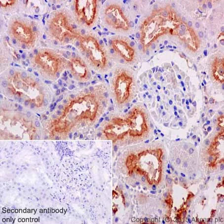 Immunohistochemistry (Formalin/PFA-fixed paraffin-embedded sections) - Anti-ATP6V0D1/P39 antibody [EPR18320] - BSA and Azide free (AB251385)