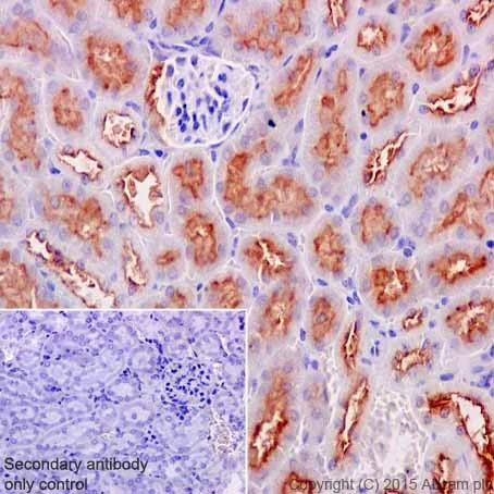 Immunohistochemistry (Formalin/PFA-fixed paraffin-embedded sections) - Anti-ATP6V0D1/P39 antibody [EPR18320] - BSA and Azide free (AB251385)