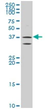 Western blot - Anti-ATP6V0D2 antibody (AB194557)