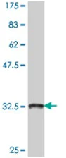 Western blot - Anti-ATP6V0D2 antibody (AB194557)