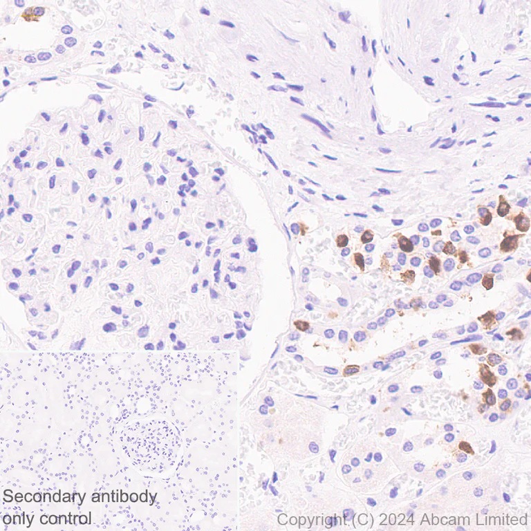 Immunohistochemistry (Formalin/PFA-fixed paraffin-embedded sections) - Anti-ATP6V0D2 antibody [EPR29173-521] (AB321809)