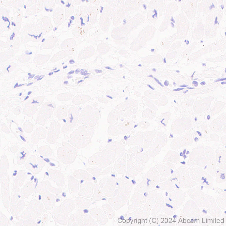 Immunohistochemistry (Formalin/PFA-fixed paraffin-embedded sections) - Anti-ATP6V0D2 antibody [EPR29173-521] (AB321809)
