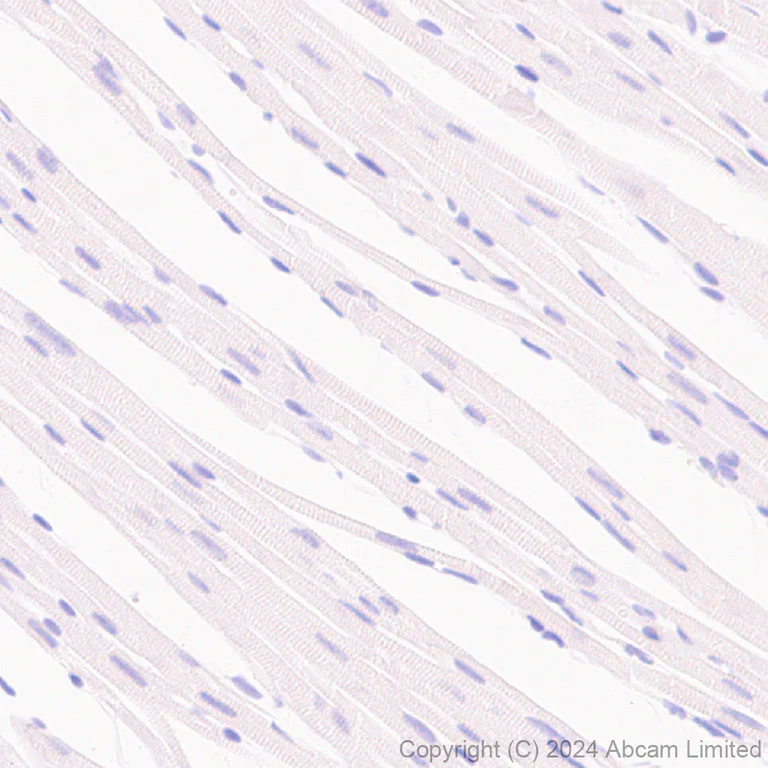 Immunohistochemistry (Formalin/PFA-fixed paraffin-embedded sections) - Anti-ATP6V0D2 antibody [EPR29173-521] - BSA and Azide free (AB321810)